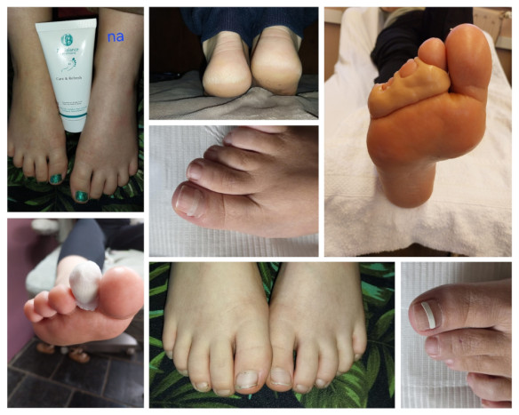 Healthy Feet Moerbeke, Moerbeke (Lokeren)
